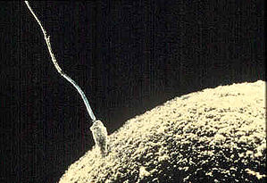 spermatozoon